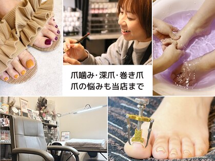 アリノール(allinol)の写真