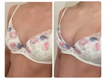 モナンジュ(ramonange)/初回とのバスト変化