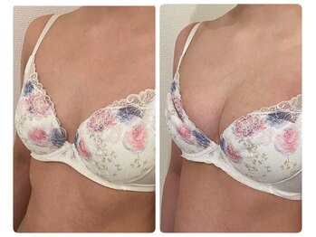 モナンジュ(ramonange)/初回とのバスト変化