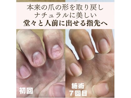 ポノポ(ponopo)の写真