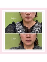 ル フラーズ(Les Fleurs)/げっそりした