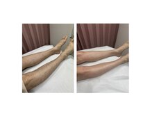 モアラニ(Moalani)の雰囲気（男性のお客様も行きやすいサロン！メンズ脱毛は当たり前の時代♪）