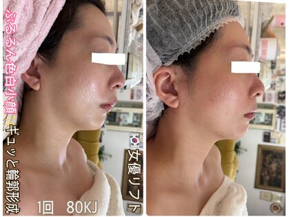 アルページュ(Arpege)の写真