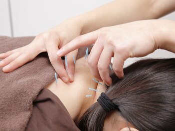 東船橋ひびき整骨院の写真/【肩こりや腰痛に悩む方に最適な鍼メニューがオススメ】深部の凝りにアプローチ◎自律神経を整え免疫UP！
