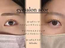 アコル(acor)