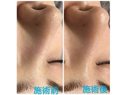 スムース(Smoooth)の写真