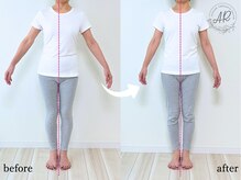 エーアール(AR)/【Before/After】