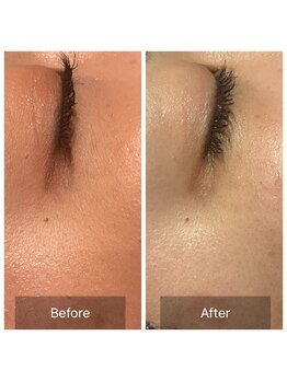 トータルエステサロン ポイント(POINT)の写真/シミ・くすみにアプローチ!透明感溢れる、なめらかで艶やかな素肌を目指して。