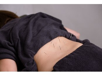 フロー鍼灸整体院(FLOW鍼灸整体院)/鍼灸施術