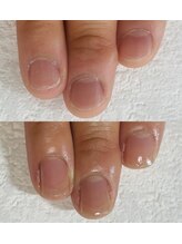 シーネイル(C Nail)/縦長美爪になれる