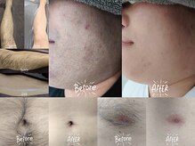 ジュゴン(Dugong)の雰囲気（数々のBefore＆After【脱毛継続率93.8％】効果と価格に大満足！）