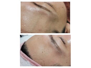 エスボーテ(sbeaute)/ヌクレールフェイシャルワックス