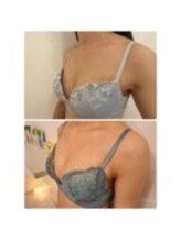 美人バスト 表参道店/【バストアップ/育乳 症例】