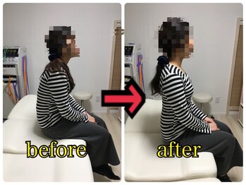 ひかり/姿勢/腰痛改善