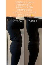 ヨサパーク ミミン(YOSA PARK mimin)/姿勢改善すると見た目が変わる！