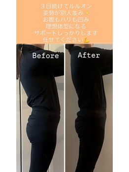ヨサパーク ミミン(YOSA PARK mimin)/姿勢改善すると見た目が変わる！