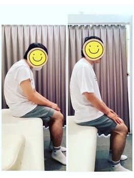 いおり骨盤整体 リブート(RE:BOOT)/姿勢矯正ビフォーアフター