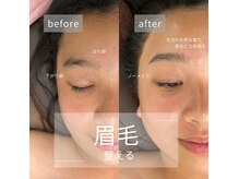 リモア(REMORE)の雰囲気（大人気のハリウッドブロウリフト眉毛に悩んでいる方にオススメ）