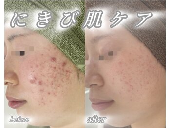 サロンデュ ひゃーく(Salon du ひゃーく)/～お肌ケア～