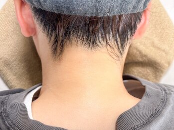 アトレ(Attrait)の写真/顔・ワキ・腕・背中・脚・VIOなど各パーツからリーズナブルな都度払いで施術可能◎複数パーツで更に割引！
