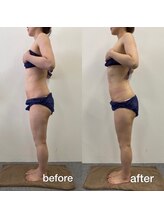 キアラ(chiara)/40代一回施術後