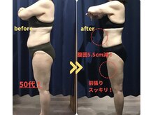 オーバー365 上田店(OVER365)/50代A様　3ヶ月チャレンジ