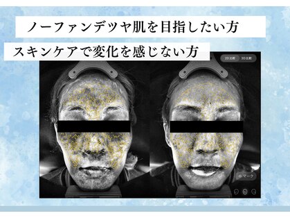 アンジェラックス スキンケアセンター心斎橋の写真