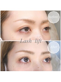 トータルビューティーウルウ(total beauty 潤 uru)/大人気ラッシュリフト