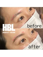 ジョリレーヌ(Jolie Reine)/ハリウッドブロウリフト