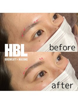 ジョリレーヌ(Jolie Reine)/ハリウッドブロウリフト