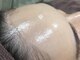 ハダハダ(HADA HADA Medical Esthetic)の写真/【韓国美肌になりたい方必見】『毛による毛穴』は脱毛で変えられる!顔脱毛+フェイシャル+角質ケア2000円★