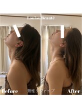 ルルボーテ(Loulou Beaute)/頚椎リヴァイブ