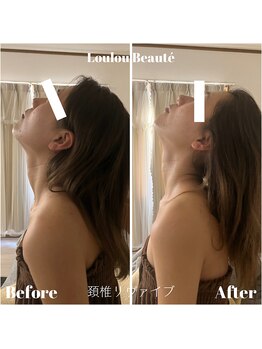 ルルボーテ(Loulou Beaute)/頚椎リヴァイブ