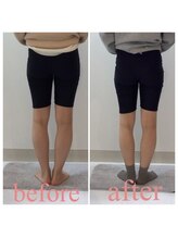 スタイルラボ高松/産後骨盤矯正の効果♪