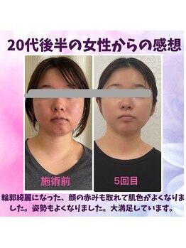 ハナノ整体院/顔のむくみがとれました