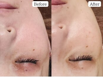 至空院/タラソトリートメント