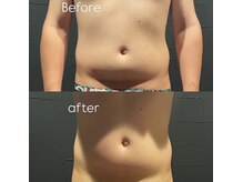 ビトタン 倉敷本店(+美to鍛)/お腹レモンボトル