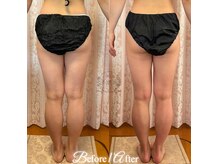 ラナンスパ(RANUN SPA)の雰囲気（本気で痩せたい方を応援割引★キャンペーン中先着3名様/新宿御苑）