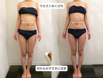 ピュアノア 垂水店/痩身人気No.2【骨格・姿勢矯正】