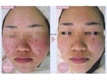 ルー(Lu)の雰囲気（◆結果重視◆筋膜リリース痩身だけじゃない！肌質改善も得意！）