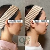 キュープ 富士店(Qpu)