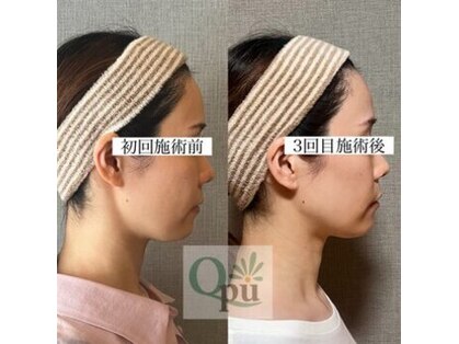 キュープ 富士店(Qpu)の写真