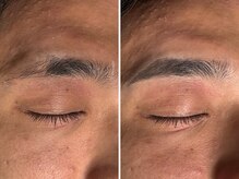 凛眉(LINVI)/眉尻のみメイク仕上げ