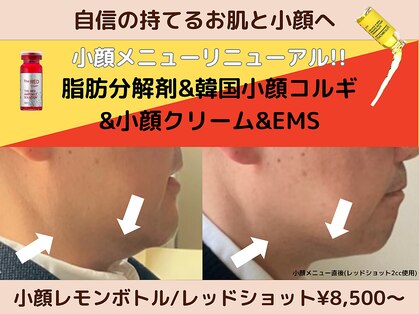 フェリス(feliz)の写真