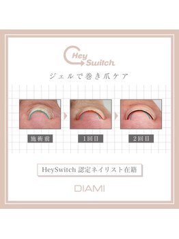 Primpの写真/【カウンセリング＋巻き爪補正￥5,960～】巻き爪補正トップクラスの技で長年の爪の悩みを低負担で改善！
