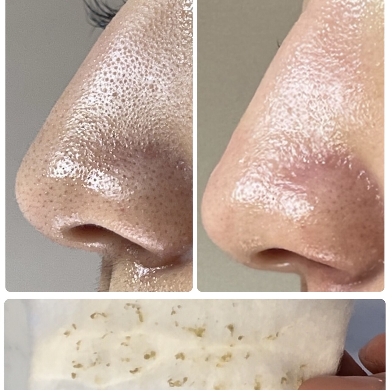 毛穴エステ 込900円