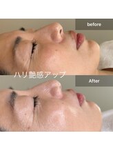 ルミエール(Lumiere)/#韓国肌管理　ハリ感アップ