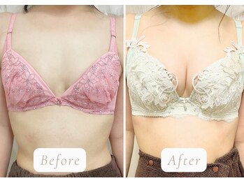 ノルン(Norn)/30代育乳バストケア（15回目）