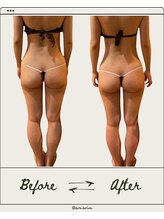 ドゥ ドルチェ(Due dolce)/女性らしいくびれも誕生　1回