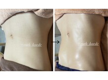 ルース(Ruth)の雰囲気（【腸もみ】足、骨盤から整える新腸もみ！）
